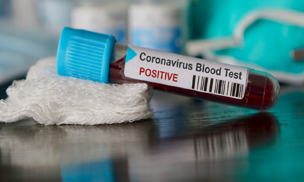 Coronavirus test
