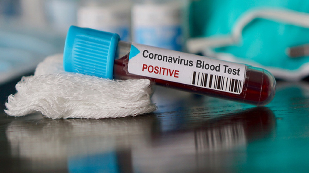 Coronavirus test