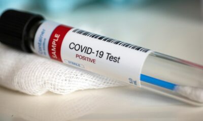 covid-19-swab-test-positive