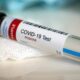 covid-19-swab-test-positive
